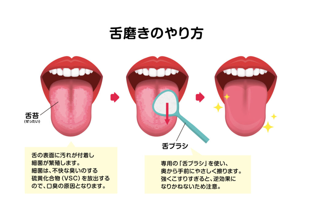 舌磨きのやり方をまとめたイラスト